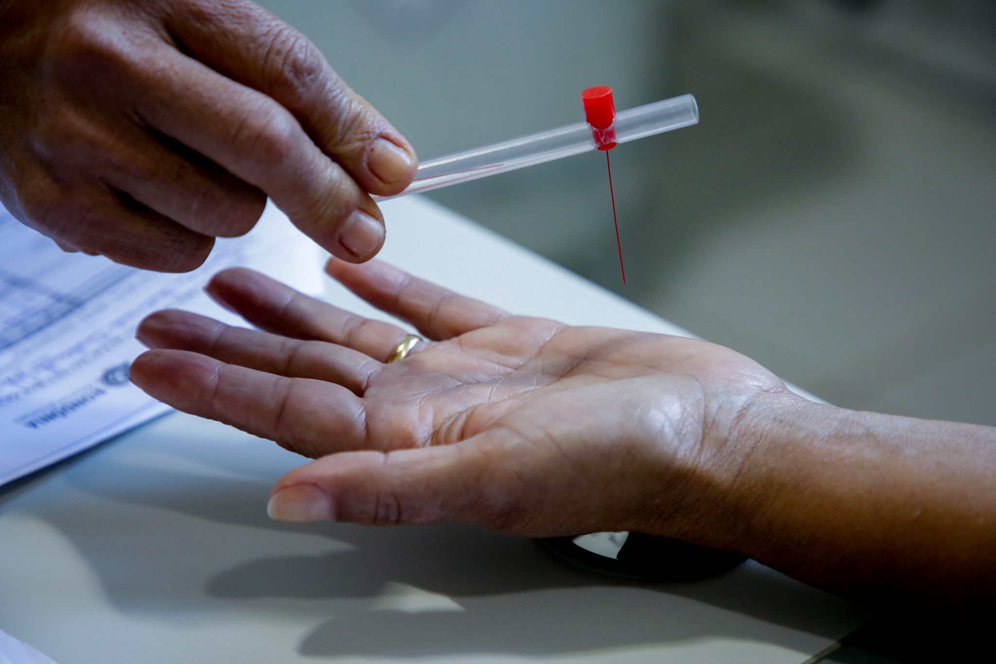 Governo de Rondônia prepara campanha “Janeiro Roxo” de combate à hanseníase