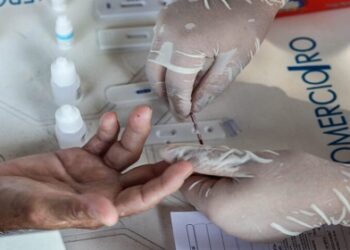 Testes e tratamento antirretroviral são disponibilizados na rede estadual de saúde