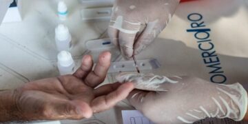 Testes e tratamento antirretroviral são disponibilizados na rede estadual de saúde