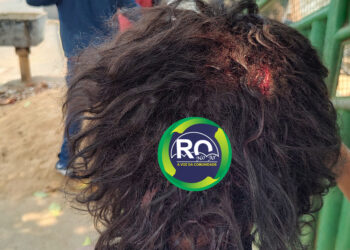 Mulher depois de ser agredida pelo marido com facão disse ” eu amo ele”