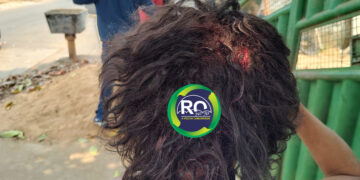 Mulher depois de ser agredida pelo marido com facão disse ” eu amo ele”