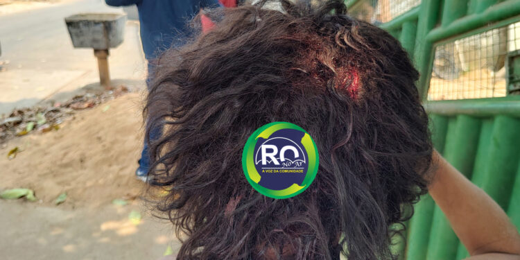 Mulher depois de ser agredida pelo marido com facão disse ” eu amo ele”