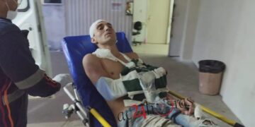 Faccionados espancam e amputam dedo de morador do bairro Taquari