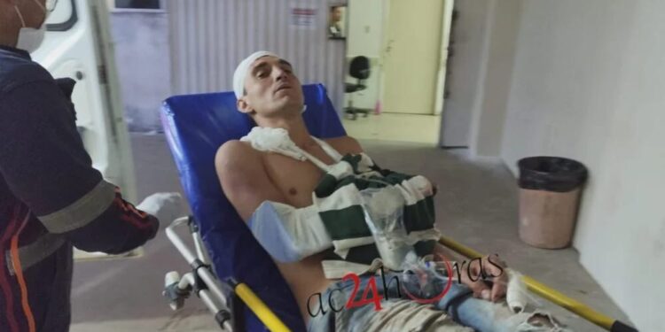 Faccionados espancam e amputam dedo de morador do bairro Taquari