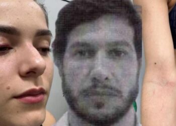 Barraco: Miss diz ter apanhado por ciúme e marido atirador denuncia armação em BO
