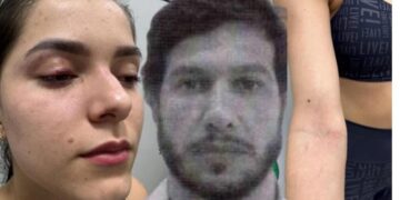 Barraco: Miss diz ter apanhado por ciúme e marido atirador denuncia armação em BO