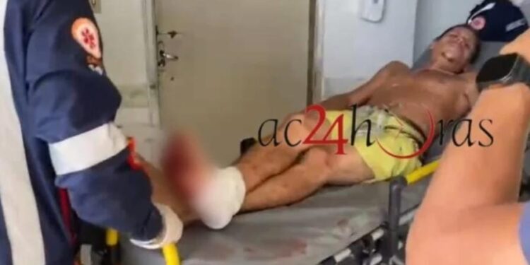 Jovem é ferido a tiro ao tentar colher cajá no Cidade Nova