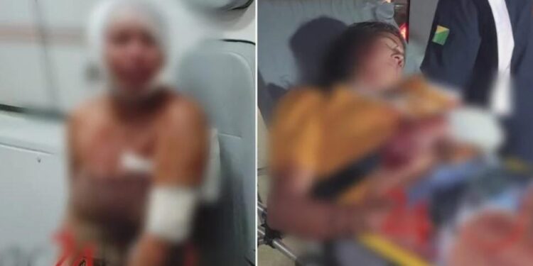 Discussão em distribuidora termina com duas mulheres feridas em Rio Branco