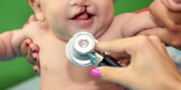 Cuidado especializado: governo de RO agenda consultas para pacientes com fissuras labiopalatinas por WhatsApp