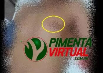 Nasceu de novo – Homem leva facada próximo ao coração e sobrevive por pouco em Pimenta Bueno