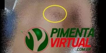 Nasceu de novo – Homem leva facada próximo ao coração e sobrevive por pouco em Pimenta Bueno