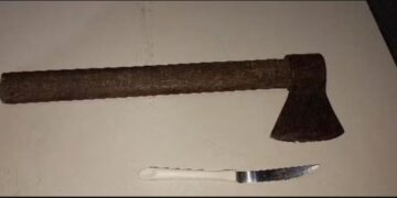 Homem tentou matar sua ex mulher com golpes de machado e faca