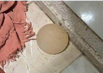Ciúme doentio: mulher tem silicone arrancado na faca pelo próprio marido
