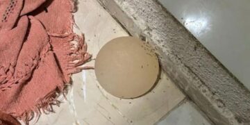 Ciúme doentio: mulher tem silicone arrancado na faca pelo próprio marido
