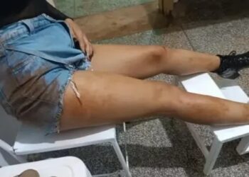 MÃE DENUNCIOU: PATAMO detém adolescente que espancou esposa de 17 anos em Porto Velho