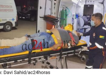 Motociclista sofre fratura na perna ao ser atingido por carro