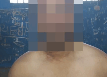 MULHER E AGREDIDA POR HOMEM QUE USOU GOLPE MATA LEÃO : HOMEM ACIONA A PM E INVENTA TER SOFRIDO TENTATIVA DE ROUBO