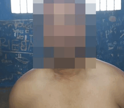 MULHER E AGREDIDA POR HOMEM QUE USOU GOLPE MATA LEÃO : HOMEM ACIONA A PM E INVENTA TER SOFRIDO TENTATIVA DE ROUBO