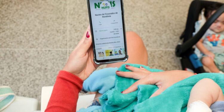 Núcleo de Fissurados de Rondônia realiza mais de 24 mil consultas e 317 cirurgias desde sua implantação