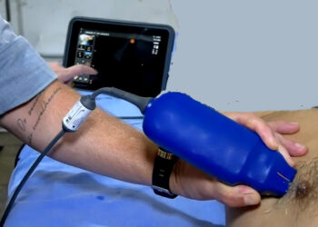 Equipamentos com tecnologia de IA agilizam exames no Pronto-Socorro João Paulo II, em Porto Velho