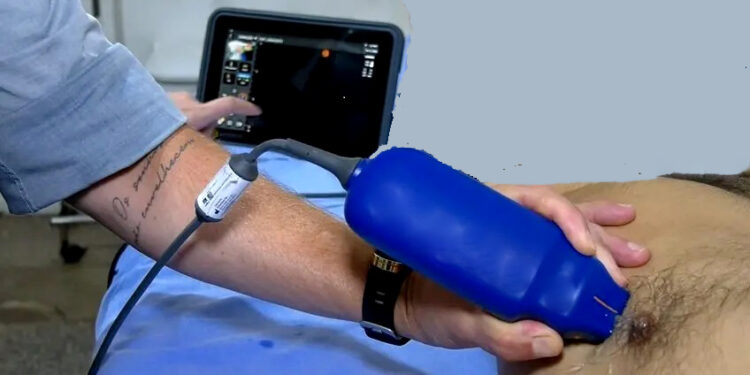 Equipamentos com tecnologia de IA agilizam exames no Pronto-Socorro João Paulo II, em Porto Velho