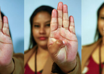 Governo de RO vai capacitar estabelecimentos públicos e privados para maior segurança e acolhimento das mulheres