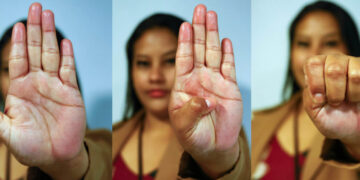 Governo de RO vai capacitar estabelecimentos públicos e privados para maior segurança e acolhimento das mulheres