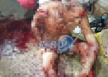 Tentativa de homicídio brutal é registrada no Setor 06; vítima é atacada com facão enquanto dormia