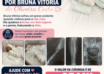 Família e amigos promovem vaquinha solidária para ajudar Bruna Vitória, motociclista ferida em acidente