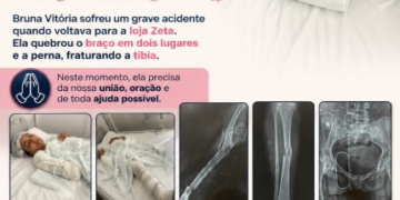Família e amigos promovem vaquinha solidária para ajudar Bruna Vitória, motociclista ferida em acidente