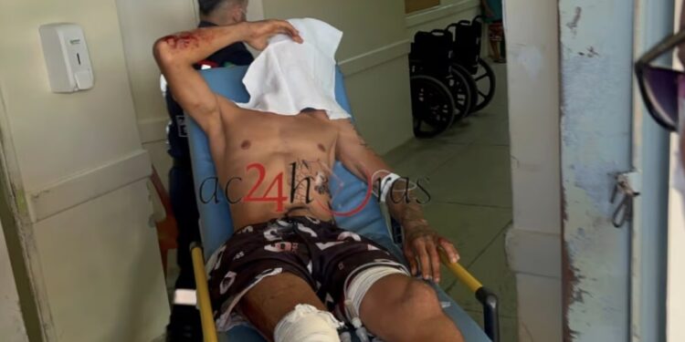 Motociclista é baleado durante tentativa de assalto na Transacreana