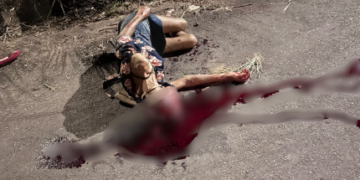 Ciclista é encontrada ferida na rua e suspeita é de que veículo tenha passado sobre sua cabeça