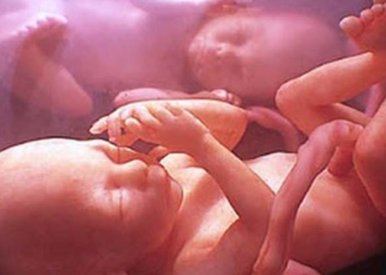 Morrem na barriga da mãe, um dia após o outro, as menininhas gêmeas que inspiraram campanha de ajuda, em Vilhena