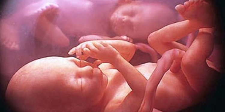 Morrem na barriga da mãe, um dia após o outro, as menininhas gêmeas que inspiraram campanha de ajuda, em Vilhena