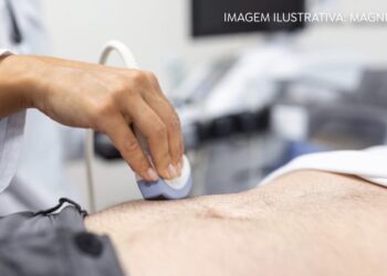 Especialista da HU Brasil detalha sintomas que podem indicar cânceres do aparelho digestivo