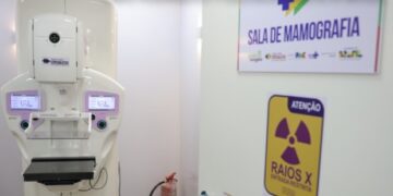 SUS amplia acesso à mamografia e ao tratamento do câncer de mama