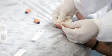 Porto Velho reduz em mais de 50% os casos de sífilis congênita com fortalecimento do pré-natal