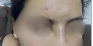 POLÍCIAIS PRENDEM SUSPEITO DE VIOLÊNCIA DOMÉSTICA APÓS AGRESSÕES CONTRA MULHER GRÁVIDA